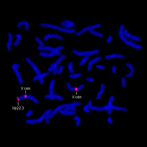Sonda para esteroide-sulfatasa