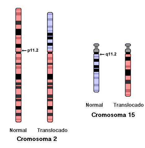 idiograma translocacin 2;15)