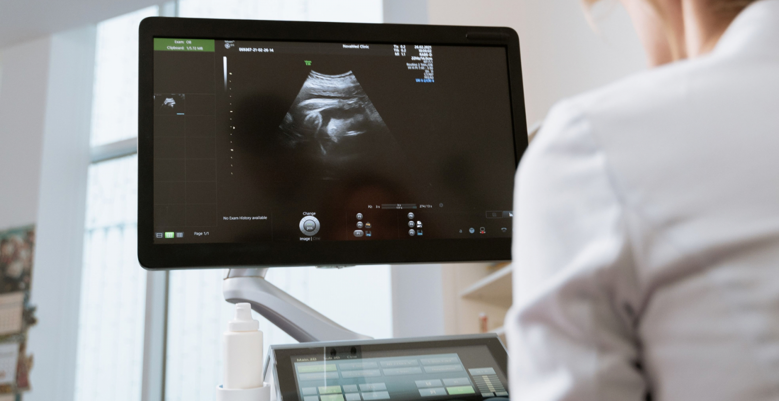 Relacionen la distribució del greix abdominal amb paràmetres de sarcopènia
